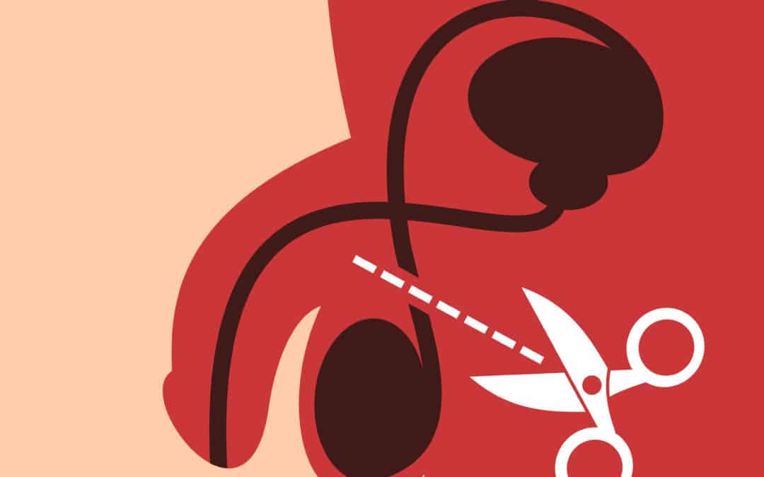 What to expect from a vasectomy